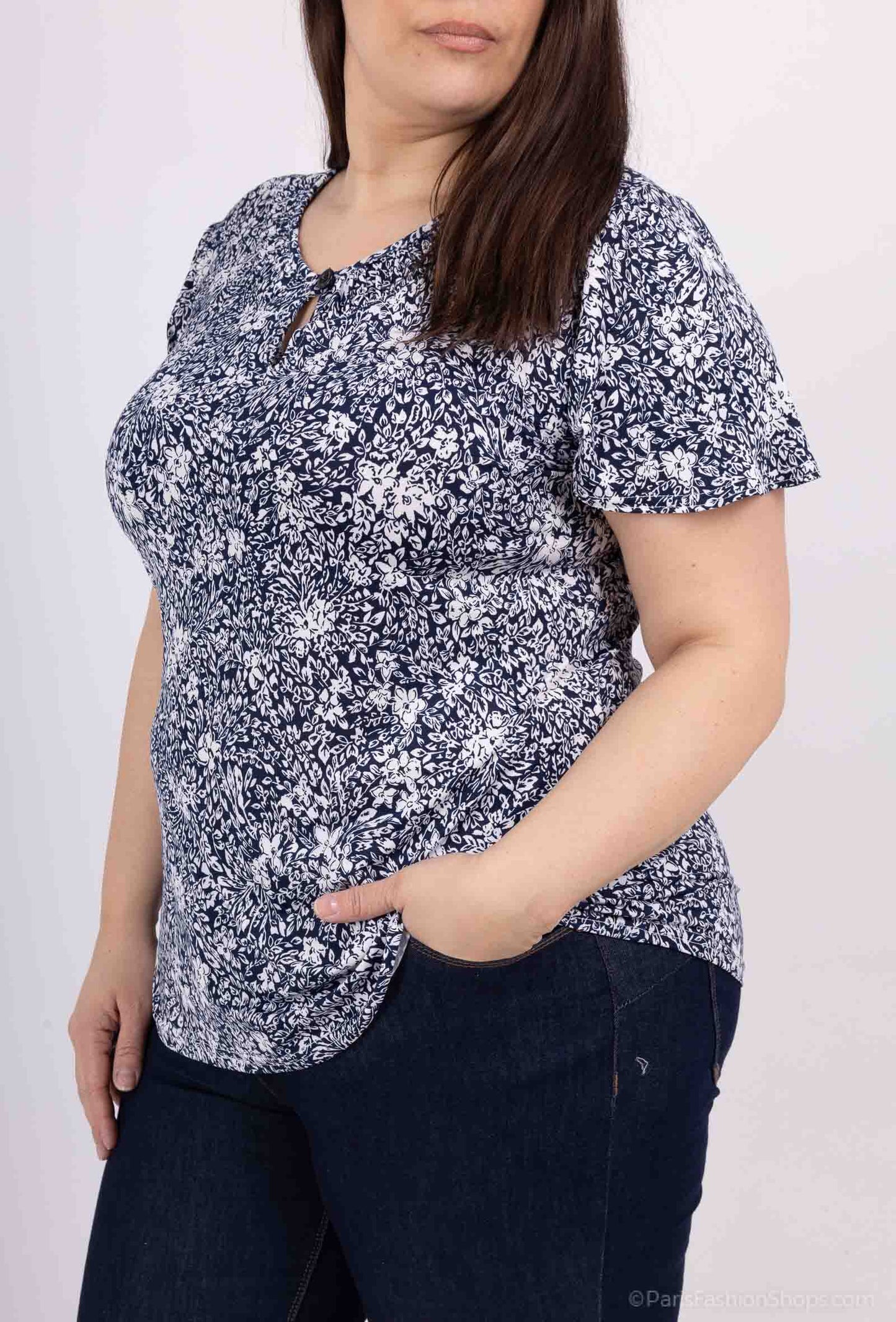 Tunics
